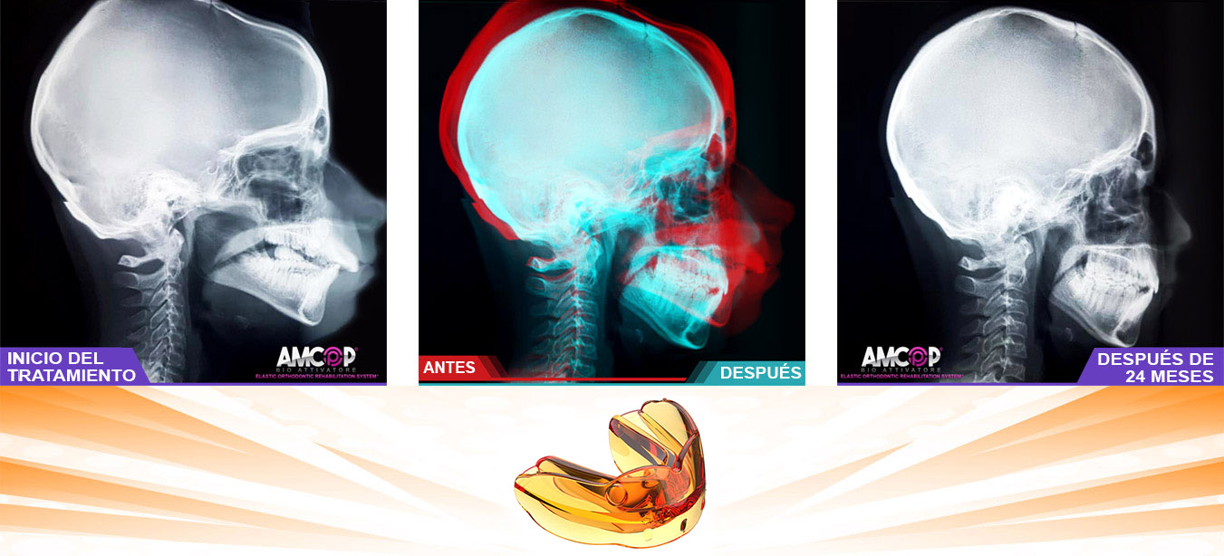 ortopedia dei mascellari cranio mandibolare